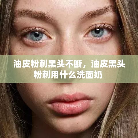 油皮粉刺黑头不断,油皮黑头粉刺用什么洗面奶