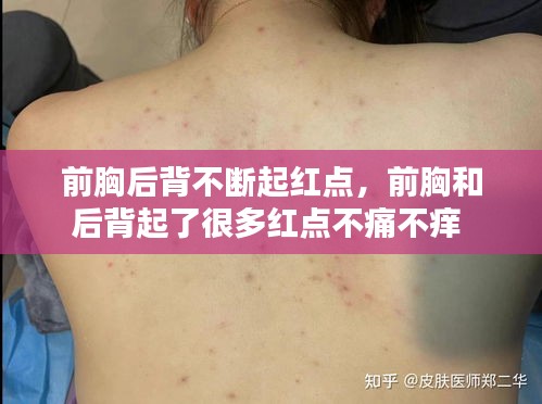前胸后背不断起红点,前胸和后背起了很多红点不痛不痒